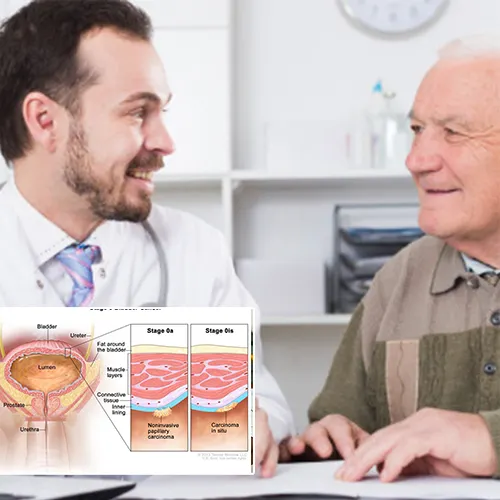 Deciding on the Right Penile Implant with   Erlanger East Hospital
